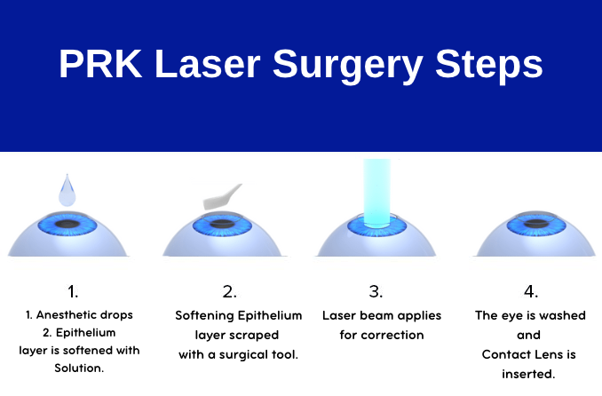 Prk Laser Eye Surgery Smart Laser Eye Center